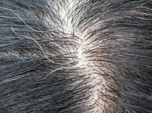 Regenera Hair Oil photo review