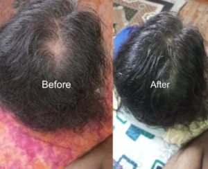 Regenera Hair Oil photo review