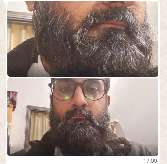 Customer Result Photo