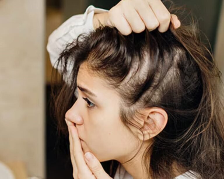 Your Hair Isn’t Thinning Overnight: Here’s What’s Really Happening